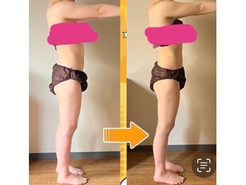 ヨサパーク エルメ 経堂(YOSA PARK Herme)/座るだけデトックスダイエット