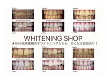 ホワイトニングショップ 沖縄市店