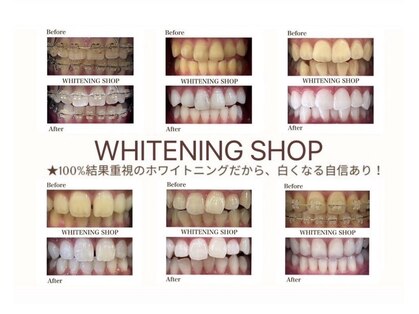 ホワイトニングショップ 沖縄市店の写真