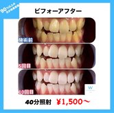 ホワイトニングショップ 米子店