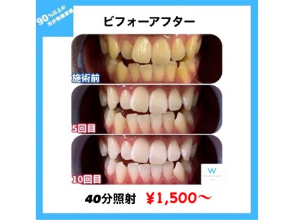 ホワイトニングショップ 米子店の写真