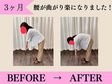 やさしい整体院 神辺店/膝が曲がり楽になりました。