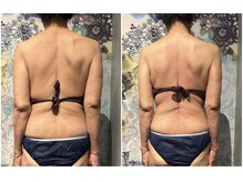 サザンベル(Southern Belle)/骨格から整える★美骨矯正