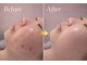 ベル 自由が丘(Belle)の写真