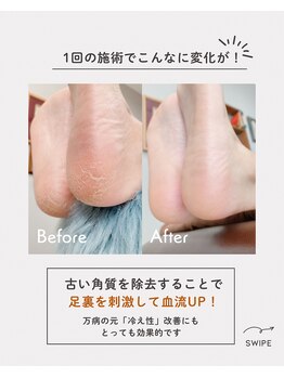 カラットネイル(CARAT Nail)の写真/ふわふわかかとを叶えるフット角質ケア！サブメニュー人気ナンバーワンで気分も上がる◎