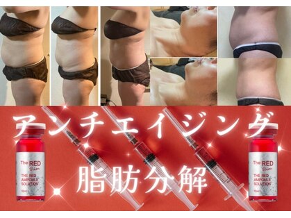 スズ(SUZU)の写真