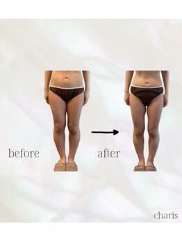 カリス(charis)/下半身痩せ
