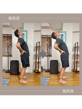 バレルメディカル研究所 恵比寿/歩けないほどの急な腰痛