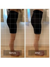 ラナン(Ranun)/きゅんきゅんヒップ