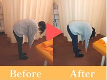 おひさま整骨院/ビフォー・アフター