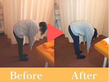 おひさま整骨院/ビフォー・アフター