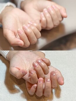アミネイル(Ami nail)の写真/深爪・薄爪・噛み爪・乾燥など爪の悩み方へ