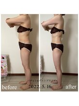 オン(On)/施術写真（横）