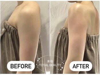 美極 銀座店/銀座/小顔コルギ/小顔矯正