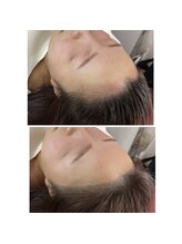 エクスクラメーションマーク(!!!)/ヘアラインアート