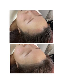 エクスクラメーションマーク(!!!)/ヘアラインアート