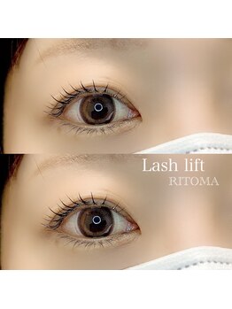 リトマ(RITOMA)/ラッシュリフト