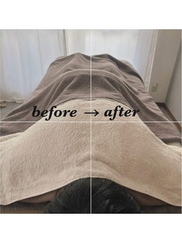 ビオエル(Bee'oele)/before after