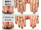 即日見た目改善！深爪ネイル♪