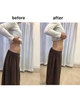 ジョワイユ(Joyeux)/腸の位置でお腹は変わる