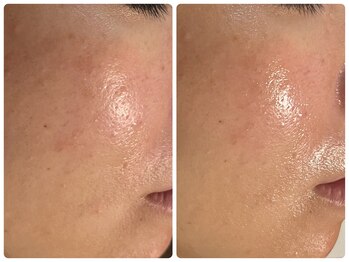 エフェクト 塚口店(effect)/Before After