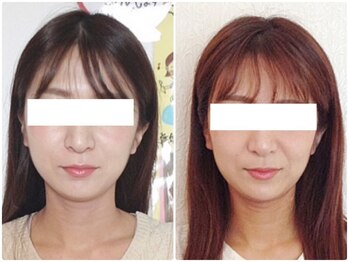 美容整体ウェリナ あま甚目寺院/小顔矯正/骨盤矯正/美脚サロン