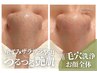【満足度No.1】W毛穴洗浄コース／お顔全体（約75分）