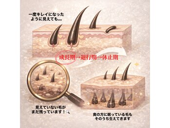 ジョエルワックス 沖縄那覇店(JOELLE WAX)/途中で脱毛をやめてしまうと、、