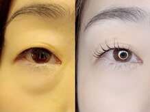 グロウビューティー(grow beauty)の雰囲気（お悩みは早く相談すればするほど解決しやすいです＾＾）