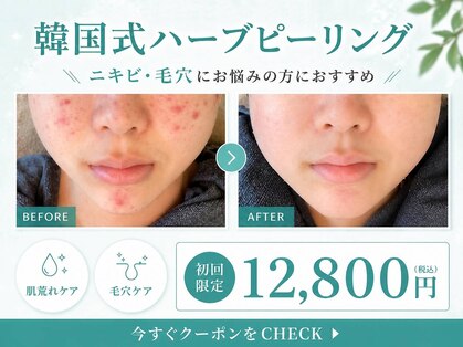 ラデュープラス(Radieux+)の写真