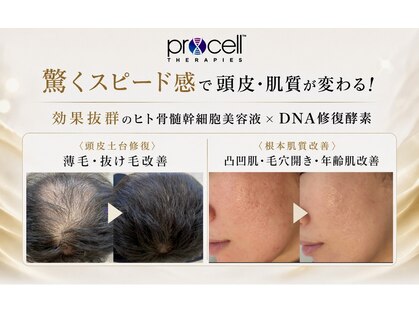 ワンブルーム(OneBloom)の写真