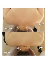 アロンドール リム(alondor rem)/before/after &nbsp;@生体電流ケア