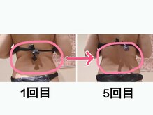 クレアボディ(CREA BODY)/背中