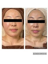 ジェミー(Gemmy)/