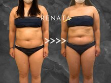 レナータ 新宿店(RENATA)/Before / After