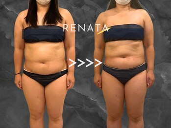 レナータ 新宿店(RENATA)/Before / After