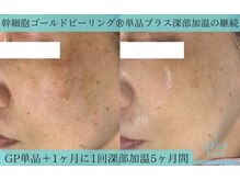 リメイククリニカルビューティー(Remake clinical beauty)/コツコツ継続