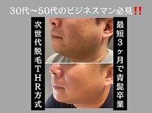エルモパリス(ELMO PARIS)の雰囲気（全身脱毛/ひげ脱毛/vio脱毛）