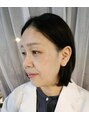 水光ピールスキン 石田 明美