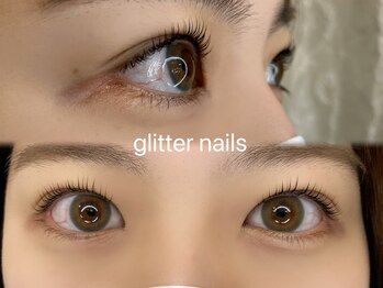 グリッターネイル(GLITTER NAILS)/【KOKONE担当】セラムラッシュ