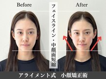 アライメント 自由が丘(Alignment)