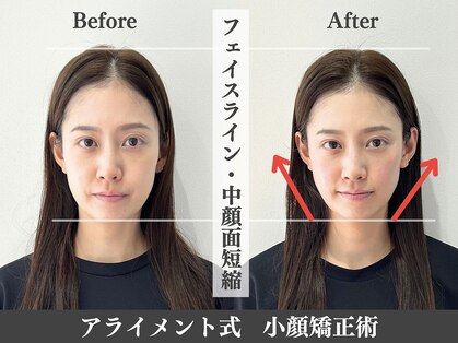 アライメント 自由が丘(Alignment)の写真