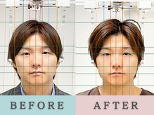 エルシンメトリー矯正院(ailesシンメトリー矯正院)/before&after　小顔矯正