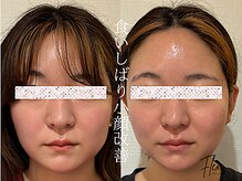 フレキシ 表参道(Flexi)の雰囲気（国家資格所有者による整体と小顔矯正でエラ張り、食いしばり解消）