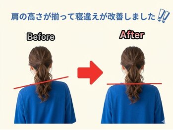のなか整体院/整体 Before→After