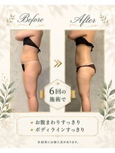 リンガ(Ringa)/6回で変わるボディライン