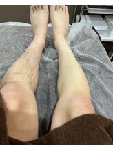 メンズキュー(Men's Cue)/ツルツルの足を手に入れよう