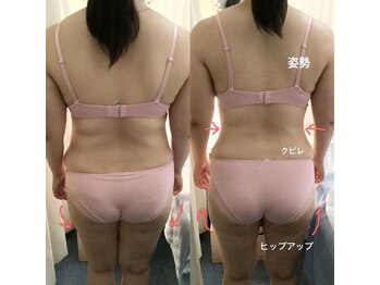 ブレスト 新宿本店(Breast)/《10回目》30代（痩身）