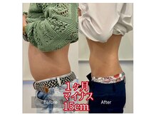 キレピア 新市街店(kirepia)/