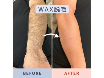 クレア 国際通りカーゴス店(CREA)/ 人気！BODY★ W A X　脱毛 
